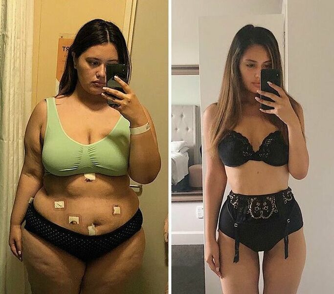 Girls before and after losing weight with NexaSlim capsules